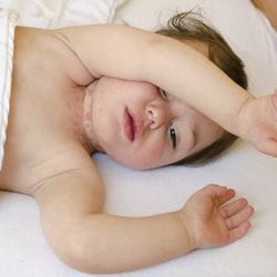 Стрептодермия у ребенка на шее