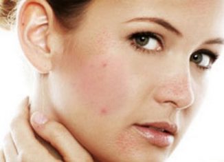 Дефекты на лице: натуральные средства, чтобы от них избавиться, рекомендации