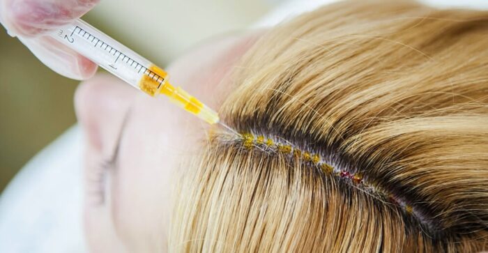 Мезотерапия для волос дома: как делать самостоятельно, советы