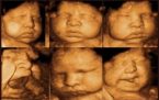 Ультразвуковое исследование на 42 недели беремености 
