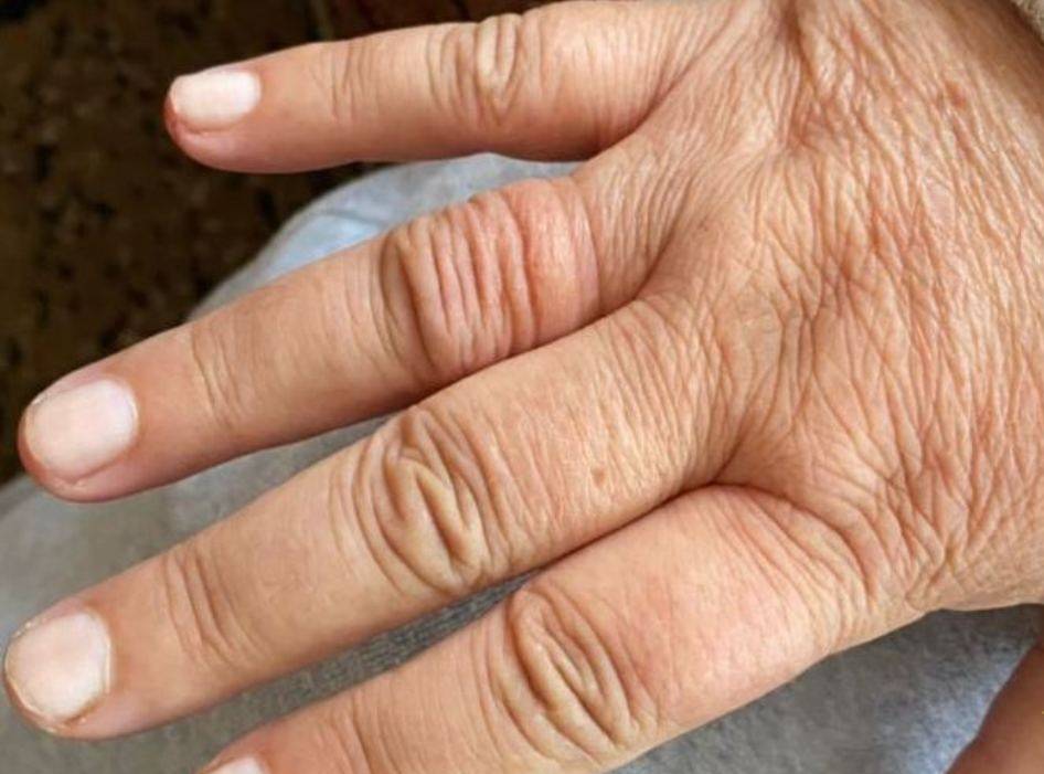 В Стародорожском районе женщина почувствовала себя плохо из-за кольца на пальце