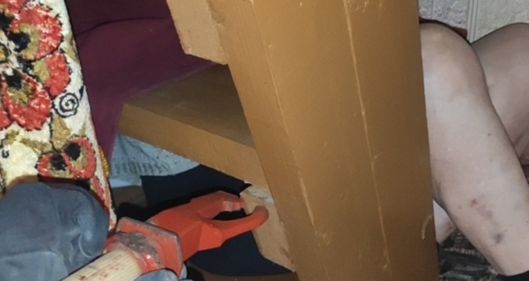 В Гомельском районе спасатели помогли пенсионерке застрявшей в лестнице