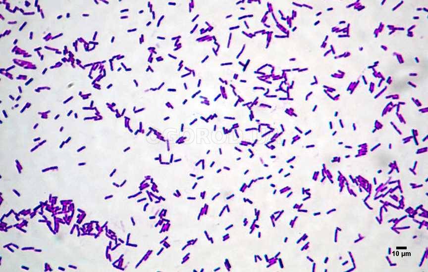 Сенная палочка: фото под микроскопом, строение бактерии, польза