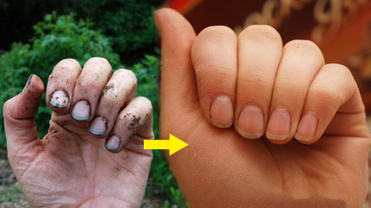 Как избавиться от грязи под ногтями после работы на огороде